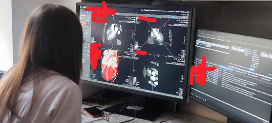 W sanockim szpitalu po raz pierwszy wykonano tomografię komputerową serca! [ZDJĘCIA]